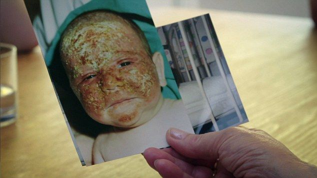 Для парня, моментально сгорающего на солнце, сделали второе лицо