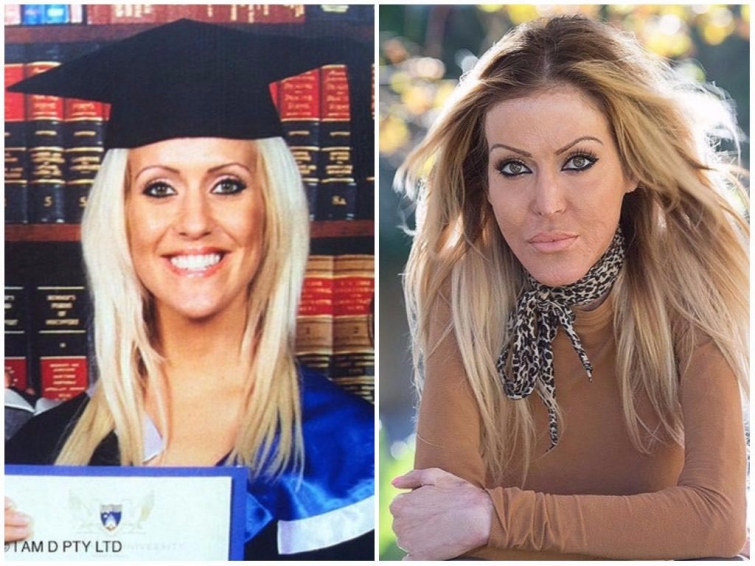 Реальные истории изуродованных девушек, которых облили кислотой Реальные истории изуродованных девушек, которых облили кислотой