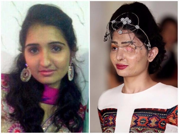 Реальные истории изуродованных девушек, которых облили кислотой Реальные истории изуродованных девушек, которых облили кислотой