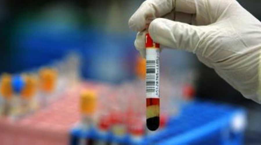 Показатели крови, предсказывающие проблемы со здоровьем Показатели крови, предсказывающие проблемы со здоровьем
