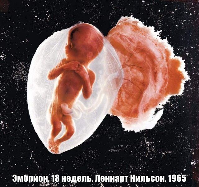 Сенсационные фотографии, которые изменили мир