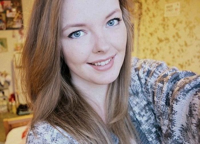 Британка страдает редким заболеванием, из-за которого спит большую часть жизнь