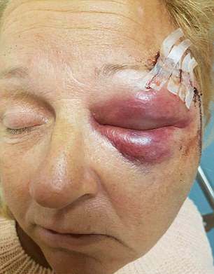 Из-за царапины над бровью женщина потеряла половину лица