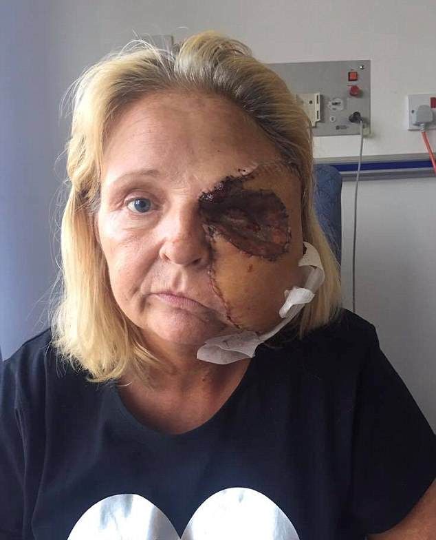 Из-за царапины над бровью женщина потеряла половину лица