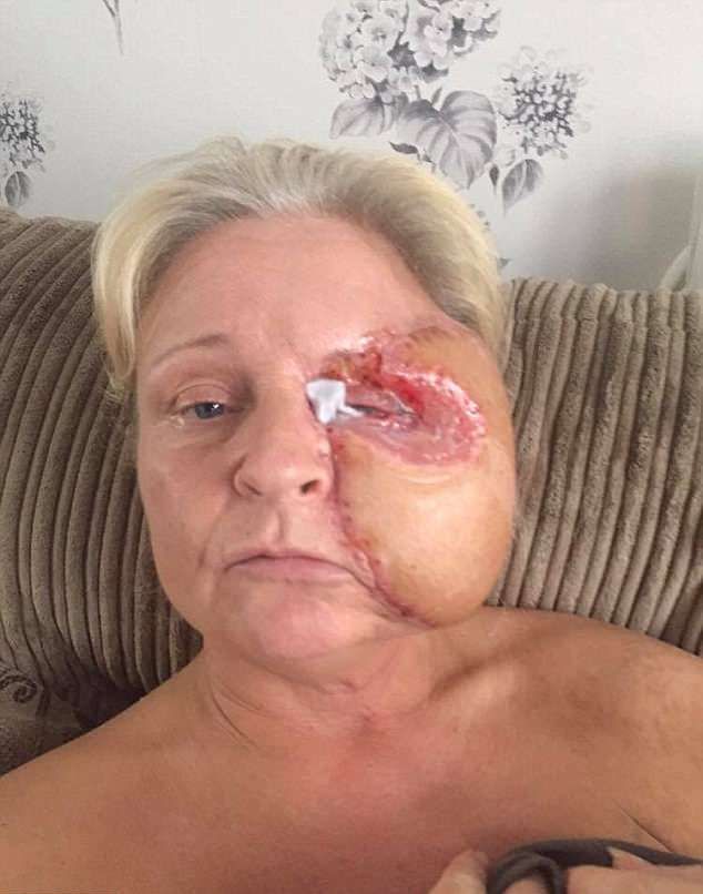 Из-за царапины над бровью женщина потеряла половину лица