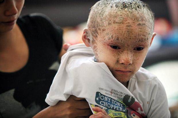 Недетские испытания, выпавшие на детскую долю, или несколько поразительных ребят, которые шокировали весь мир. Часть 2 Недетские испытания, выпавшие на детскую долю, или несколько поразительных ребят, которые шокировали весь мир. Часть 2
