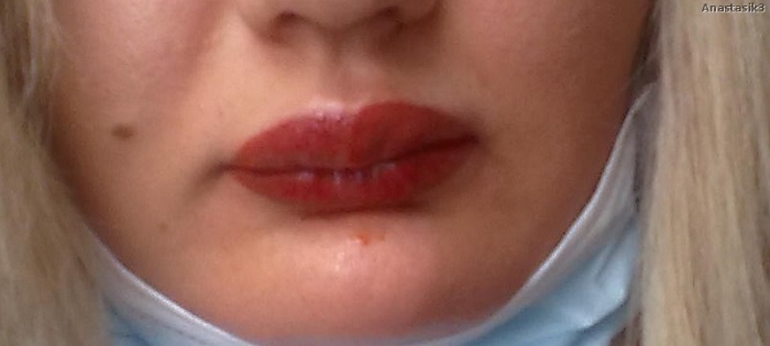 17 плачевных случаев, когда с татуажем губ что-то пошло не так