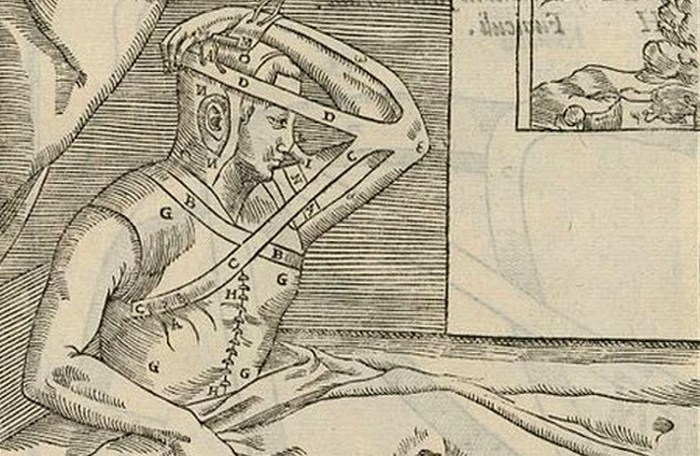 10 невероятных фактов о пластической хирургии 10 невероятных фактов о пластической хирургии