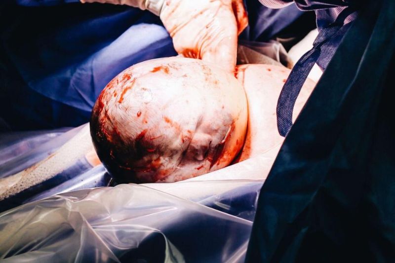 Девочка родилась головой в скафандре из рубашки