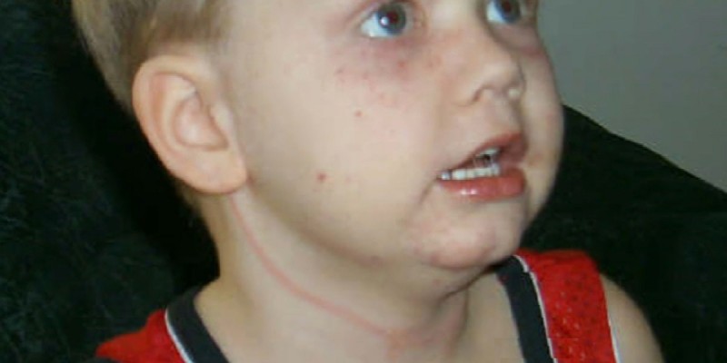 5-летний мальчик едва не погиб, запутавшись в жалюзи