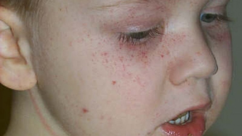 5-летний мальчик едва не погиб, запутавшись в жалюзи