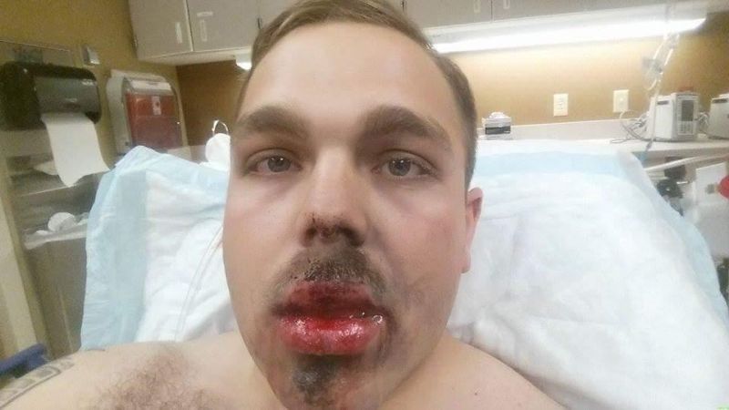 Лица вэйперов после взрыва электронной сигареты