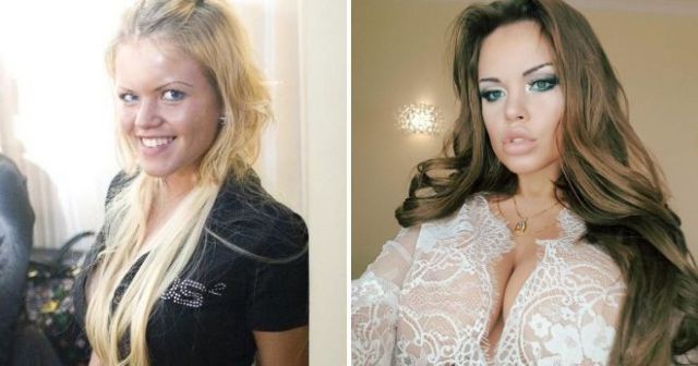 Российские звезды Instagram до и после пластических операций