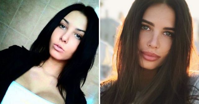 Российские звезды Instagram до и после пластических операций