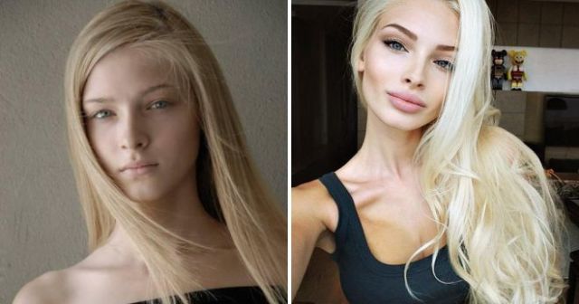 Российские звезды Instagram до и после пластических операций