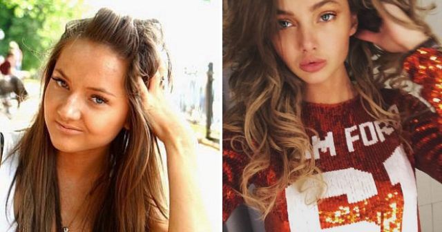 Российские звезды Instagram до и после пластических операций