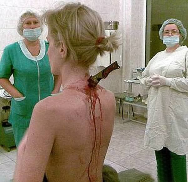 Травмы, совместимые с жизнью (9 фото)