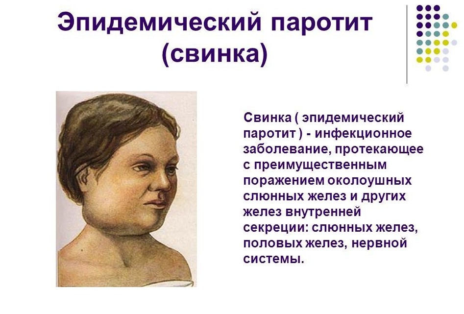 Детские заболевания, которые плохо переносят взрослые Детские заболевания, которые плохо переносят взрослые