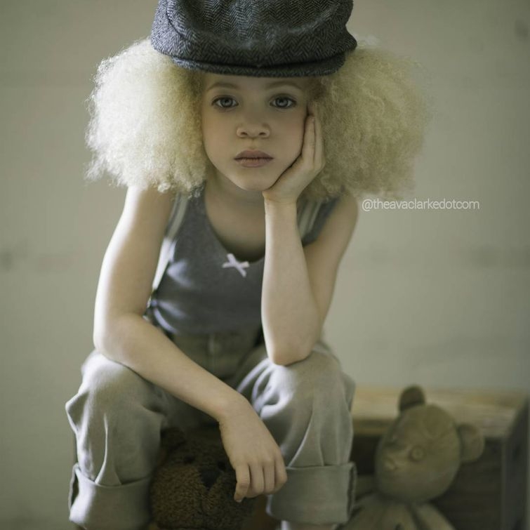 Ава Кларк – 8-летняя девочка-альбинос, ставшая юной афроамериканской моделью Ава Кларк – 8-летняя девочка-альбинос, ставшая юной афроамериканской моделью