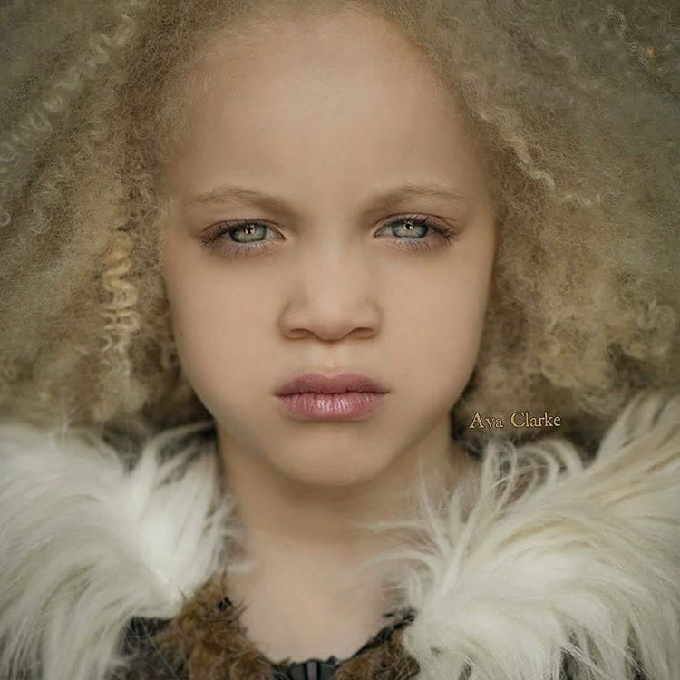 Ава Кларк – 8-летняя девочка-альбинос, ставшая юной афроамериканской моделью Ава Кларк – 8-летняя девочка-альбинос, ставшая юной афроамериканской моделью