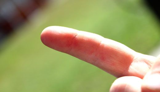 Домашняя медицина (27 фото) Домашняя медицина (27 фото)