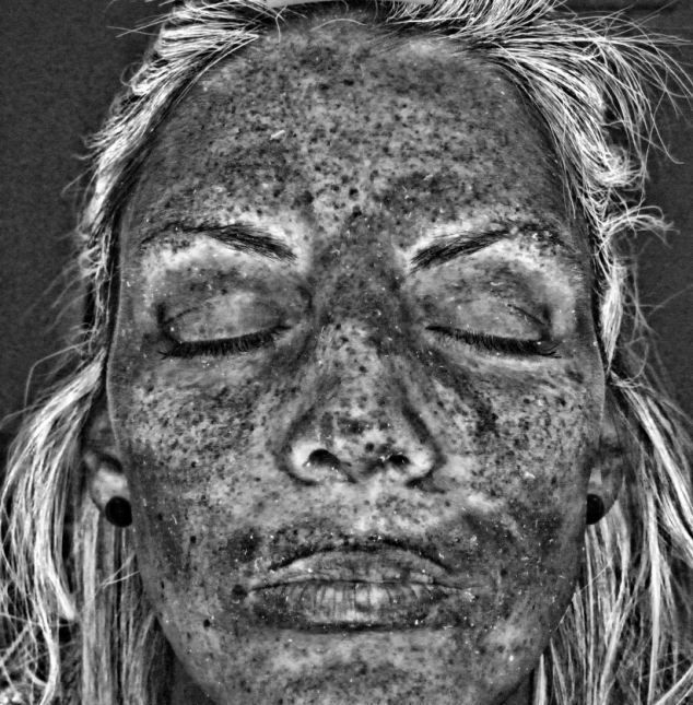 Опасность солярия