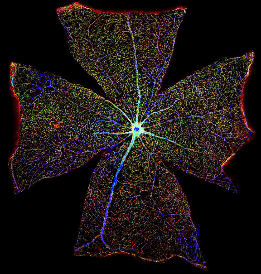 Конкурс фотографии в области биомедицины Wellcome Image Awards 2017: победители