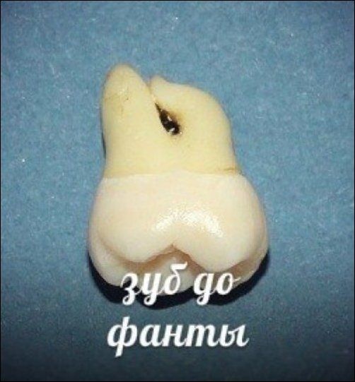 Зубы и популярные напитки (11 фото) Зубы и популярные напитки (11 фото)