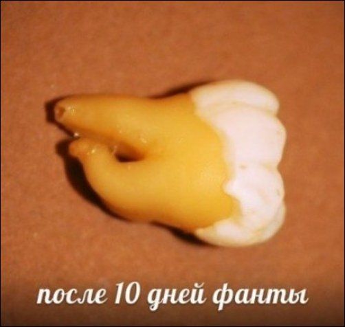 Зубы и популярные напитки