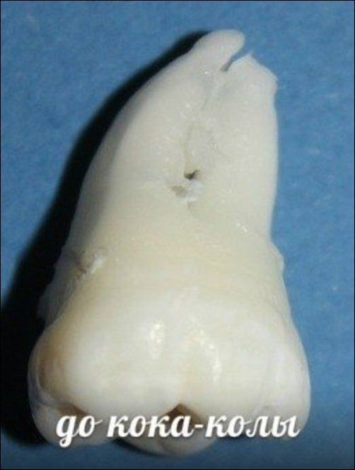 Зубы и популярные напитки