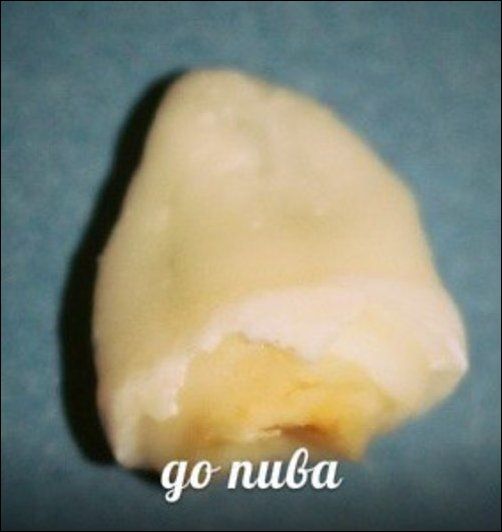 Зубы и популярные напитки