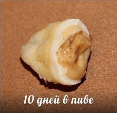 Зубы и популярные напитки