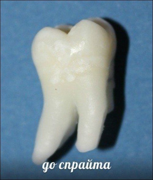 Зубы и популярные напитки