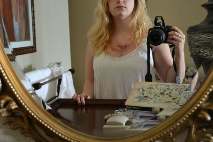 Если долго загорать под жарким солнцем (10 фото)