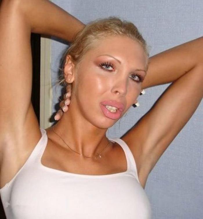Губошлепки