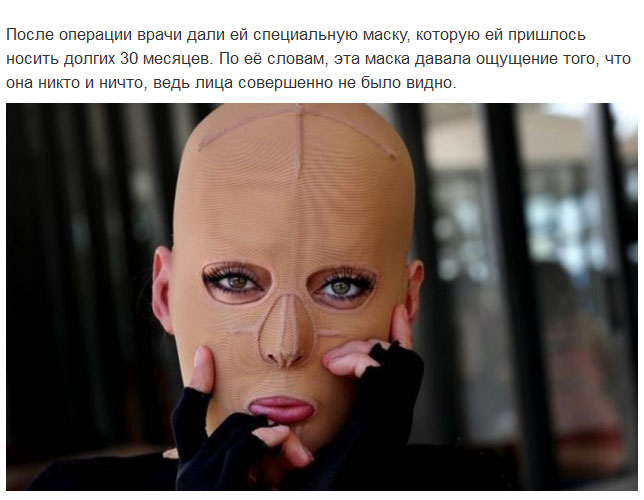 Девушка сняла маску, которую носила 2,5 года