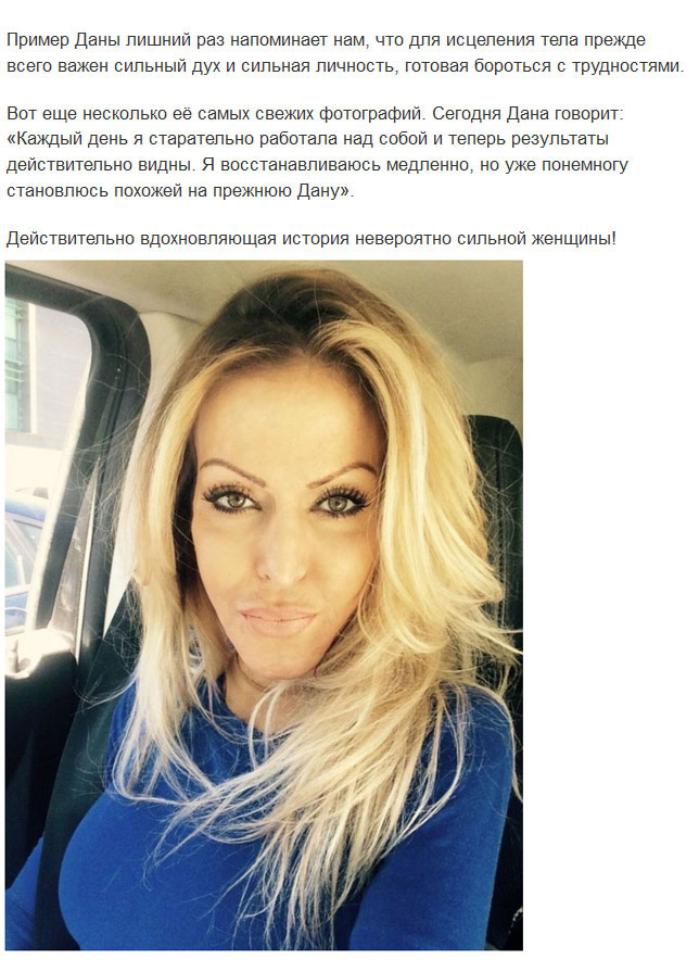 Девушка сняла маску, которую носила 2,5 года
