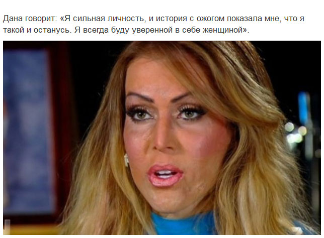 Девушка сняла маску, которую носила 2,5 года