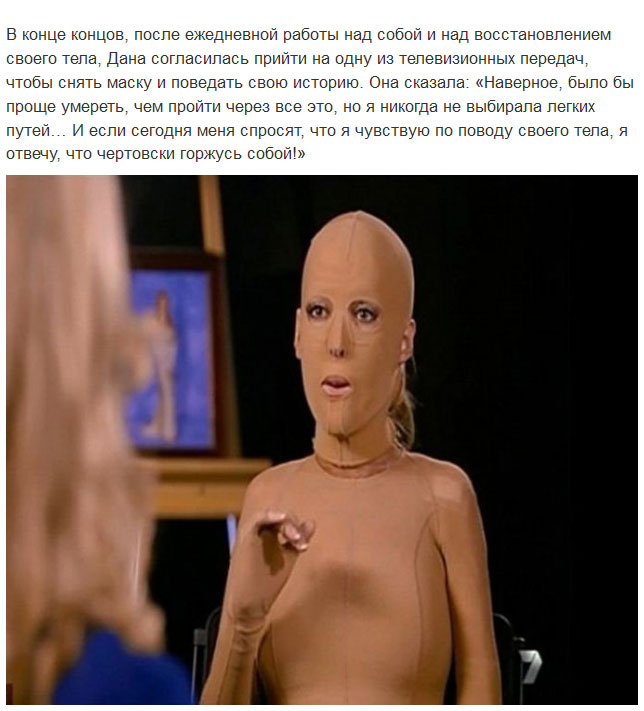 Девушка сняла маску, которую носила 2,5 года