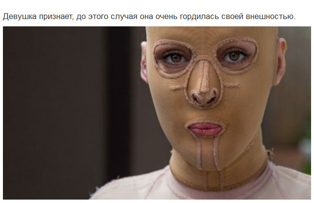 Девушка сняла маску, которую носила 2,5 года