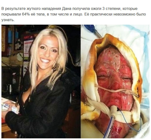 Девушка сняла маску, которую носила 2,5 года