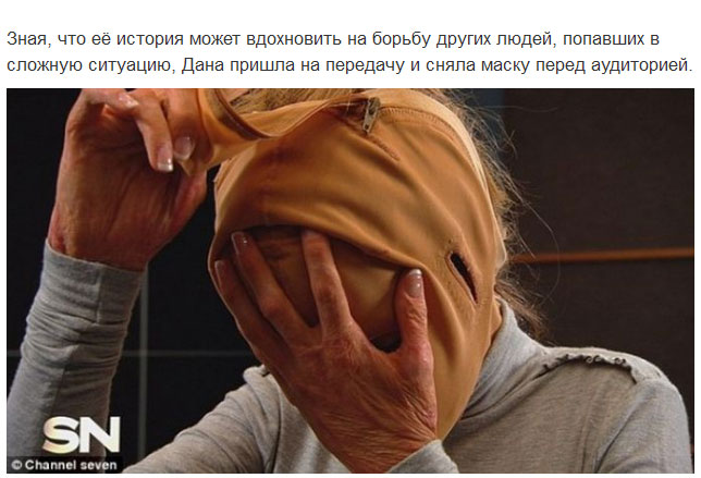 Девушка сняла маску, которую носила 2,5 года