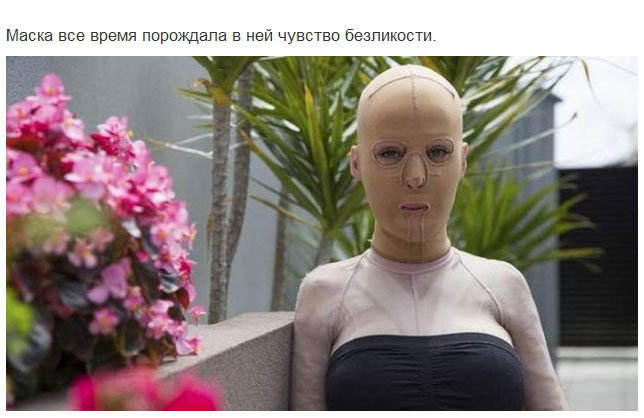 Девушка сняла маску, которую носила 2,5 года