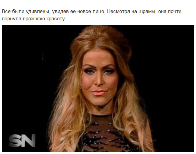 Девушка сняла маску, которую носила 2,5 года