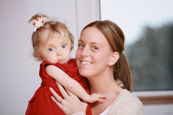 Девочка родилась с 30-ю переломами (4 фото)