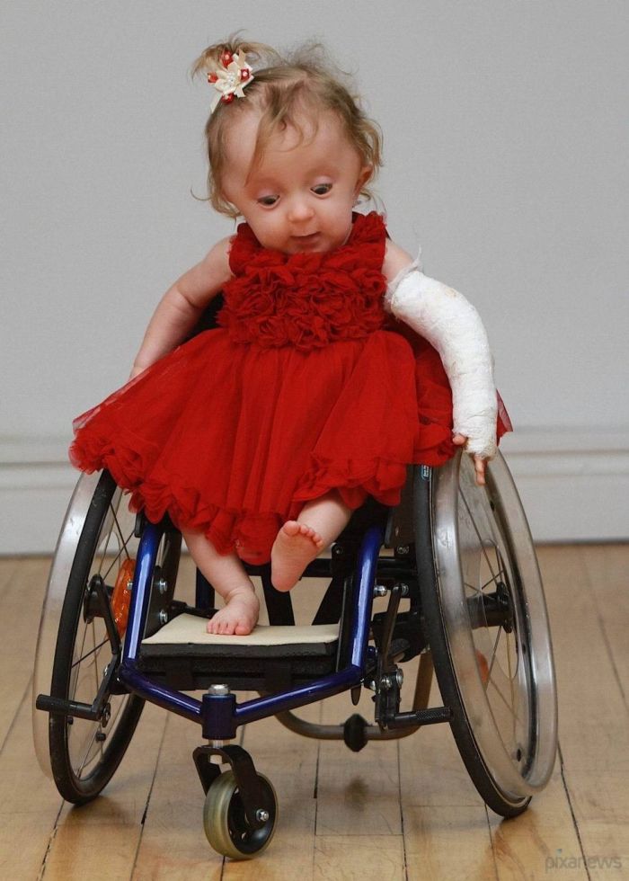 Рождение с инвалидностью. Рождение с инвалидностью. Рождение с инвалидностью. Реабилитация инвалидов. Люди сограничеными возможностями.