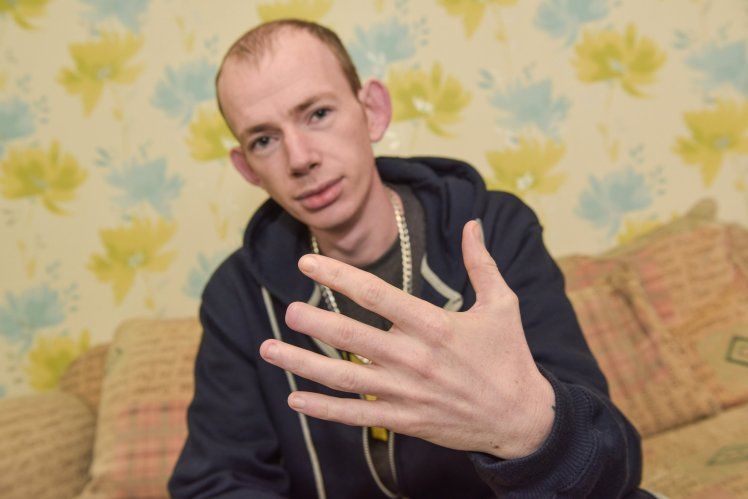 Парень проснулся с бодуна и увидел, что у него пропала часть пальца