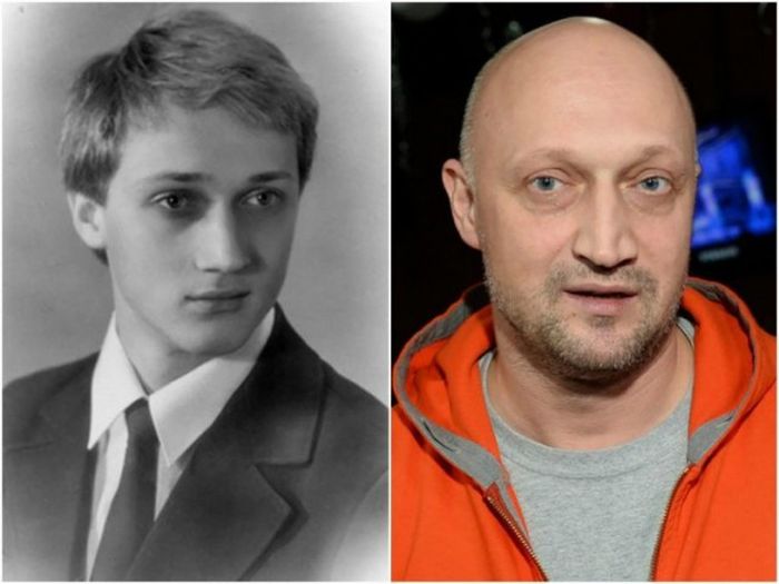 Знаменитости до потери волос