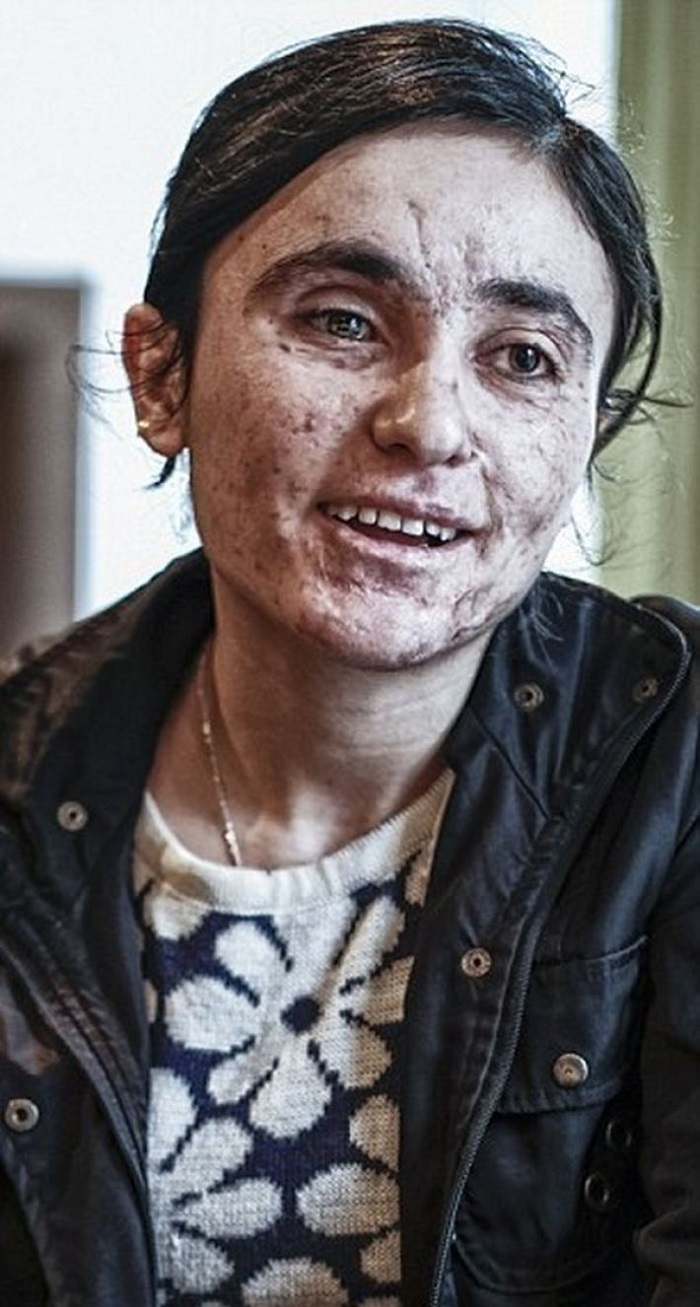 «Убейте ее или отрежьте ногу, чтобы больше не сбегала». И всё-таки это ей удалось