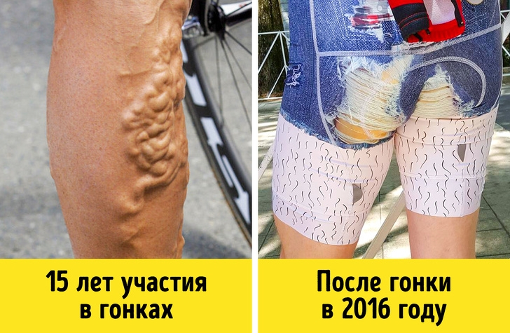 Пот, кровь и слёзы: на что идут актёры, балерины и футболисты для работы своей мечты